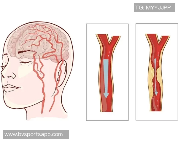 ESPN解析奥斯卡血管迷走神经性晕厥对心率和血压的影响及其机制